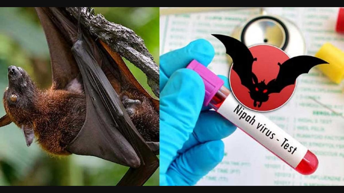 nipah virus