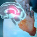 Stroke Risk