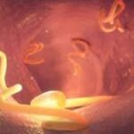 Tapeworm Pills