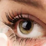 Contact Lens